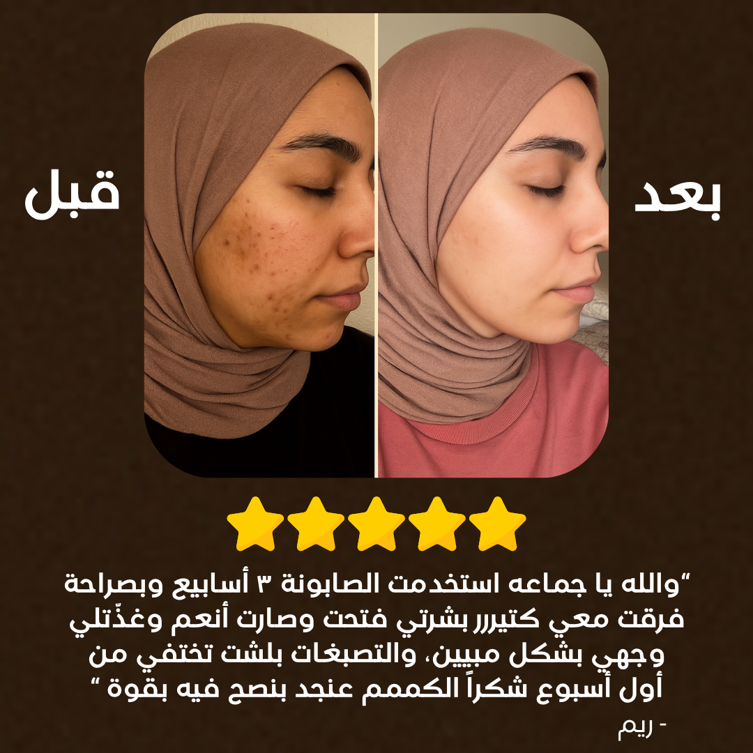 Soap for Face & Body – Each Order Includes 3 Bars™