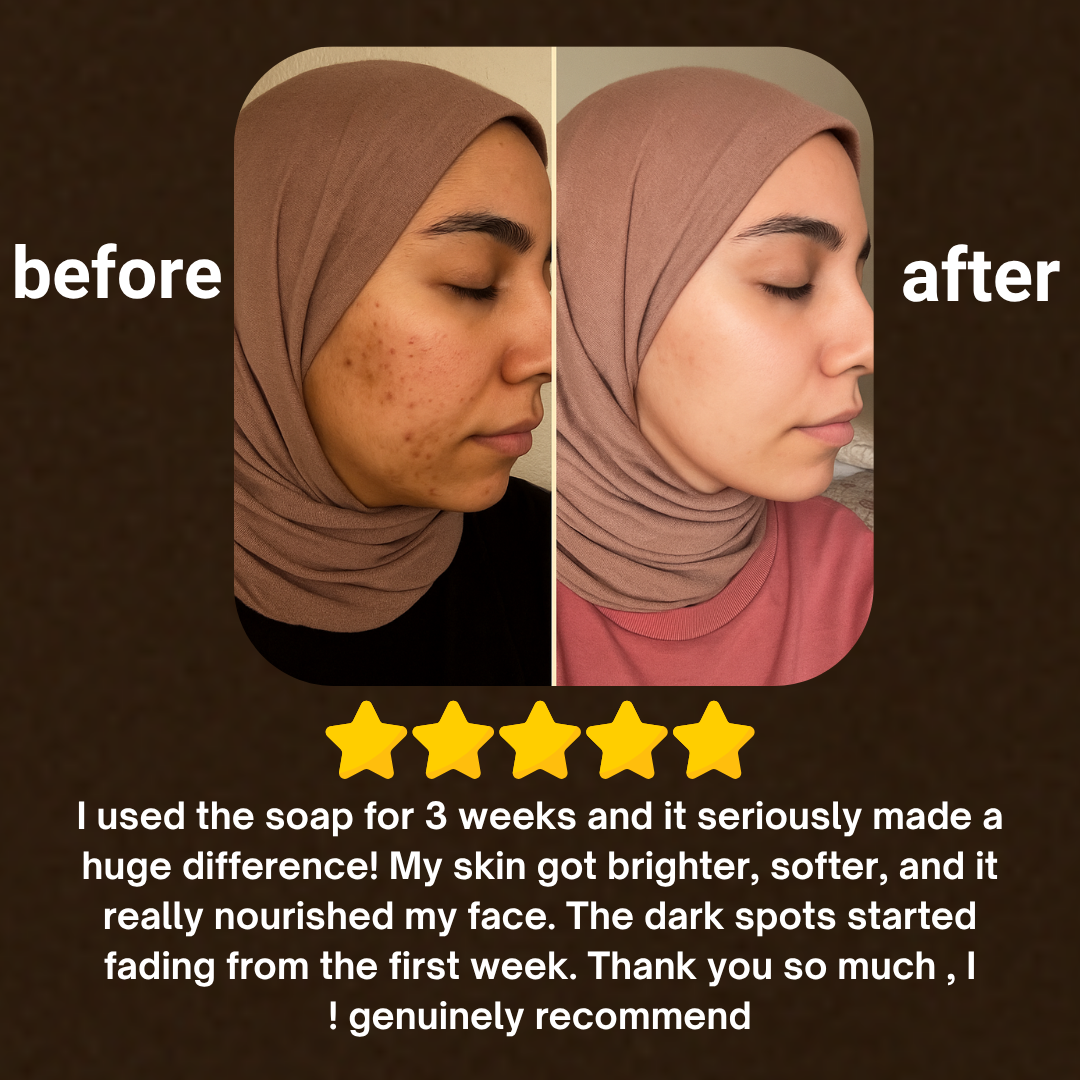 Soap for Face & Body – Each Order Includes 3 Bars™