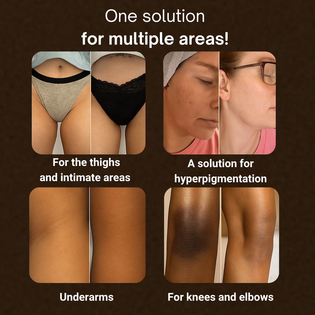 Soap for Face & Body – Each Order Includes 3 Bars™