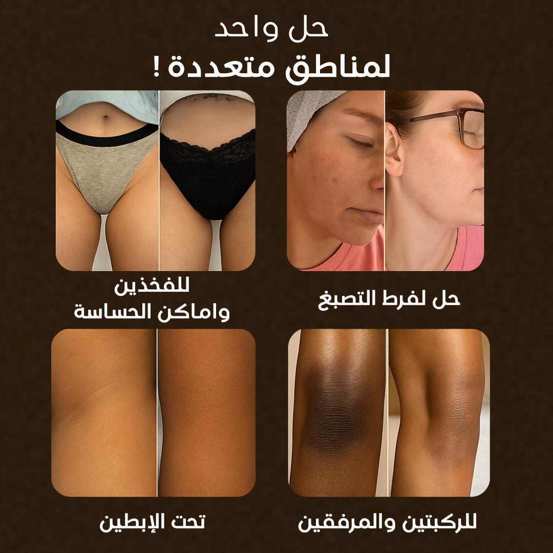Soap for Face & Body – Each Order Includes 3 Bars™