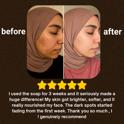 Soap for Face & Body – Each Order Includes 3 Bars™